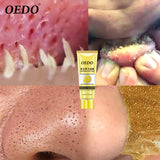 Gold Remove Blackhead Mask Shrink Pore Improve Rough Skin