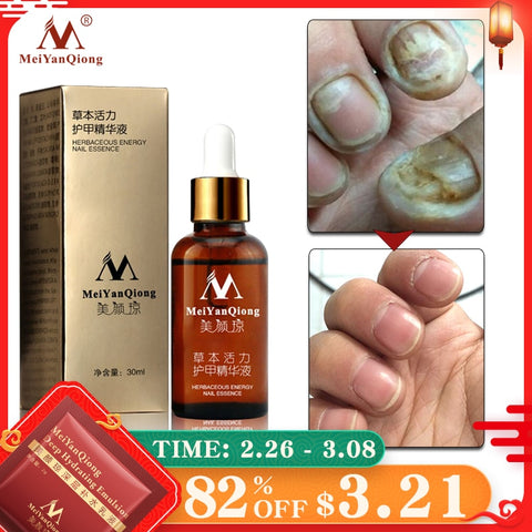 Fungal Nail Treatment Feet Care