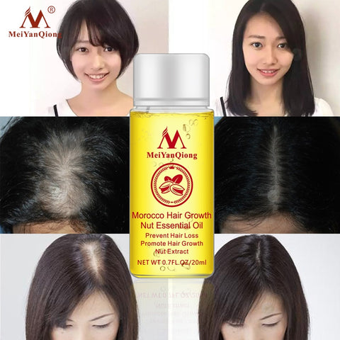 Fast Powerful Hair Growth Essence